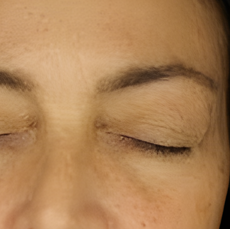 Metamorphosis Close-up of a person's eye with closed eyelids