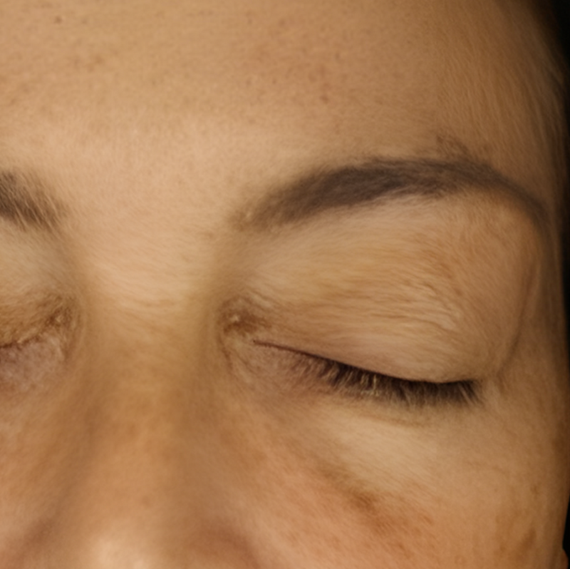 Metamorphosis Close-up of a person's eye with closed eyelids