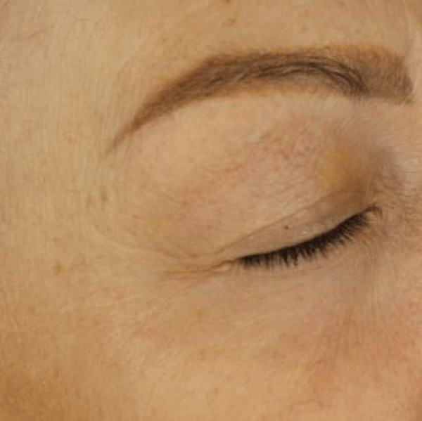 Metamorphosis Close-up of a person's eye with a focus on the eyelid and eyebrow.