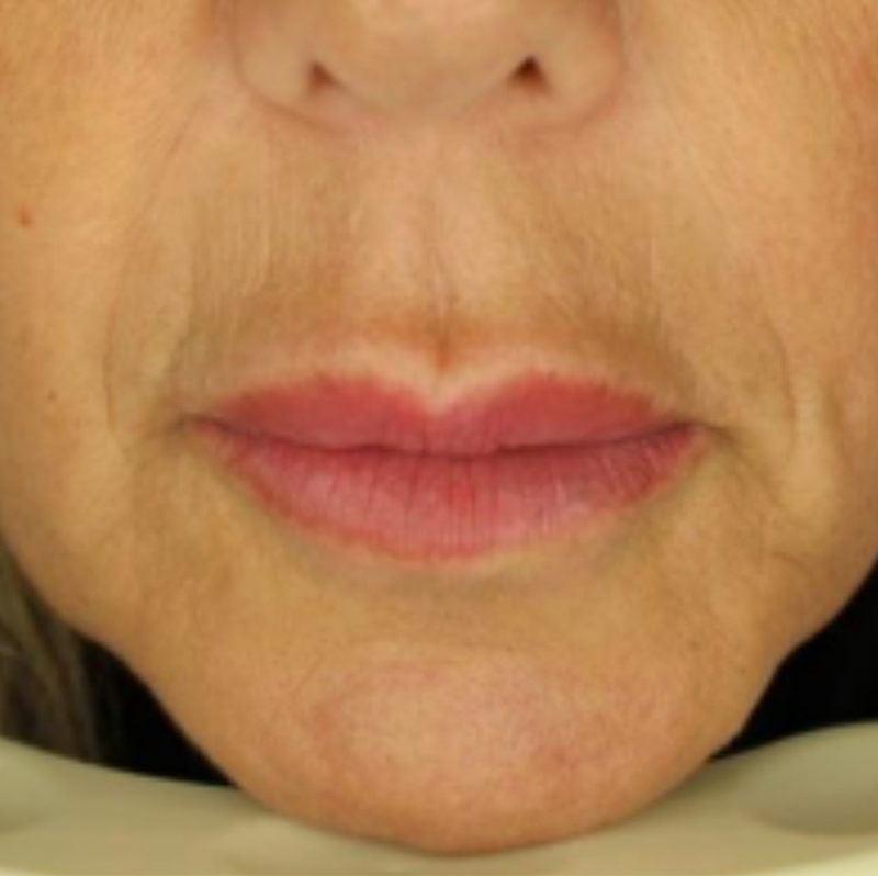 Metamorphosis Close-up of a person's lips with a blurred background