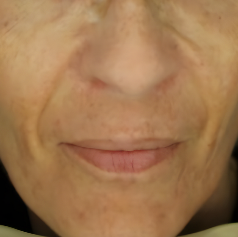 Metamorphosis Close-up of a person's nose and mouth area