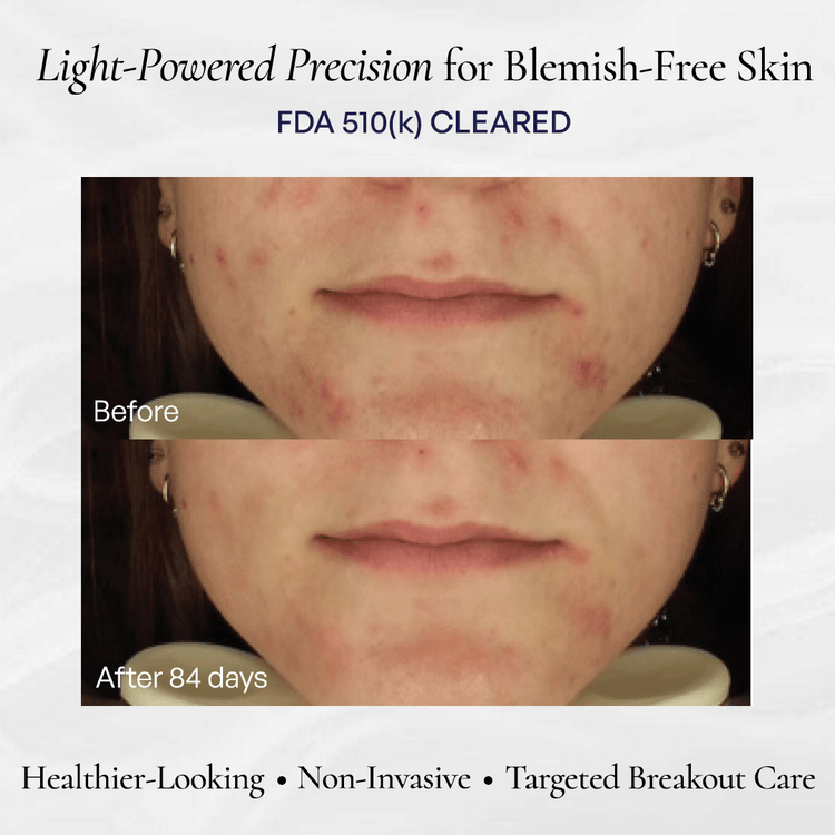 Metamorphosis Light Therapy