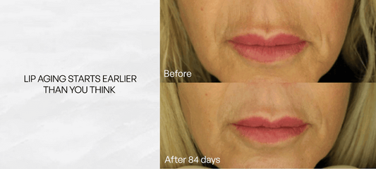 Metamorphosis Light Therapy