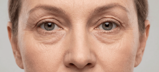 The Science Behind Under Eye Wrinkles: Why The Eye Area Ages First