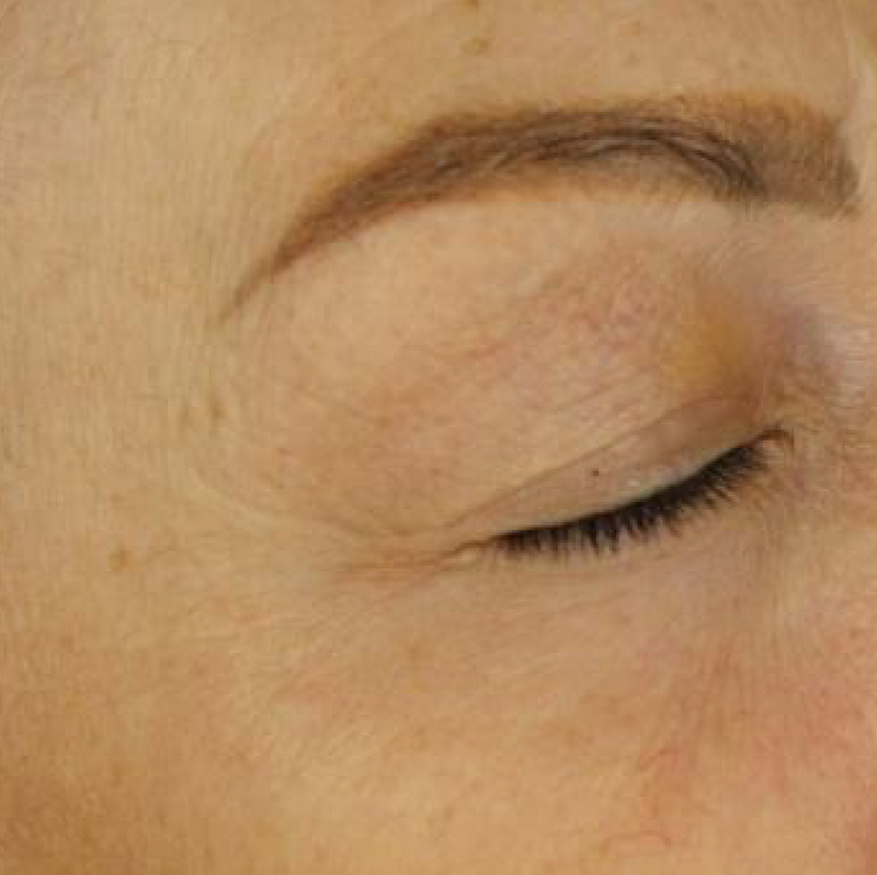 Metamorphosis Close-up of a person's eye with a focus on the eyelid and eyebrow.