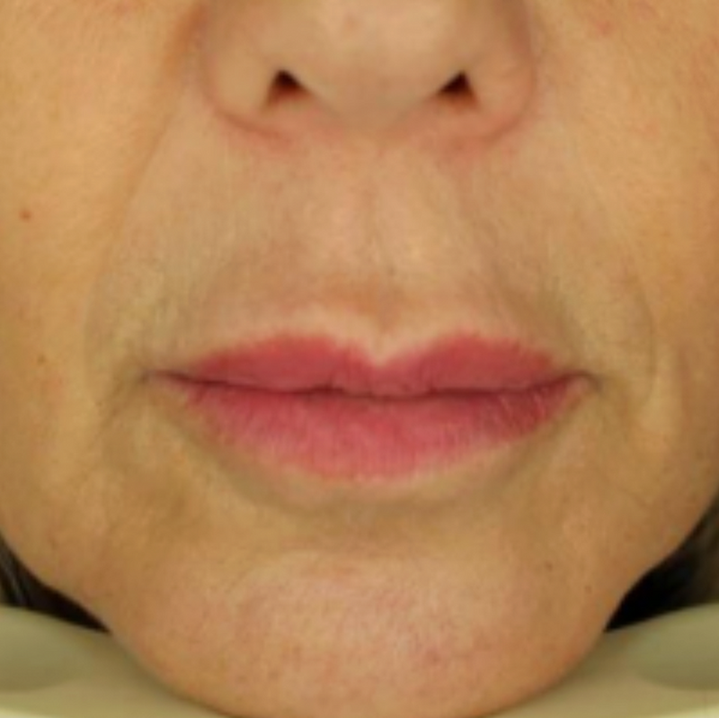 Metamorphosis Close-up of a person's lips with a blurred background