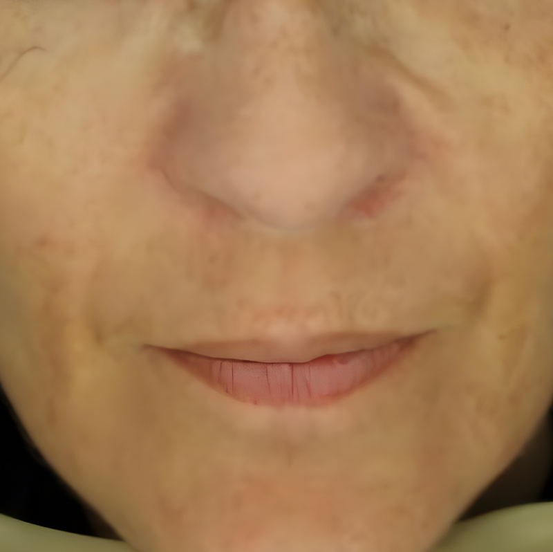 Metamorphosis Close-up of a person's nose and mouth area with visible skin texture.
