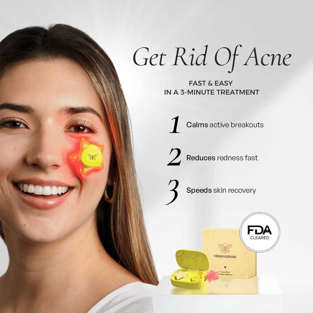 Woman using LED light therapy patch for adult hormonal acne, red light treatment device calming breakouts and reducing redness – FDA cleared acne light therapy
